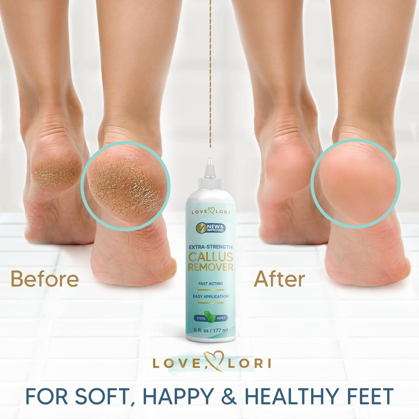 Callus Remover for Feet (Extra Strength) Foot Callus Remover Gel - Feet Scrubber, Pedicure Spa Tools, 6oz