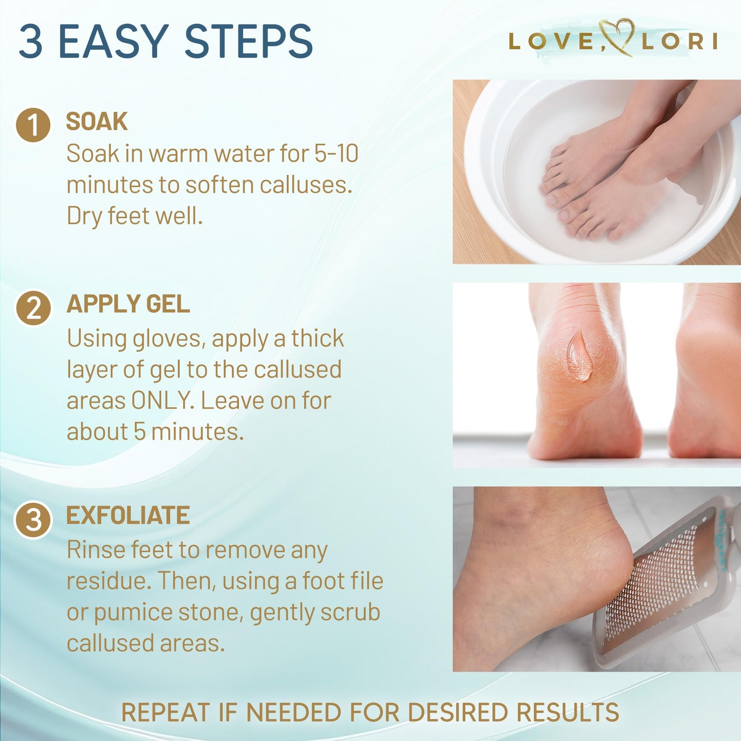 Callus Remover for Feet (Extra Strength) Foot Callus Remover Gel - Feet Scrubber, Pedicure Spa Tools, 6oz