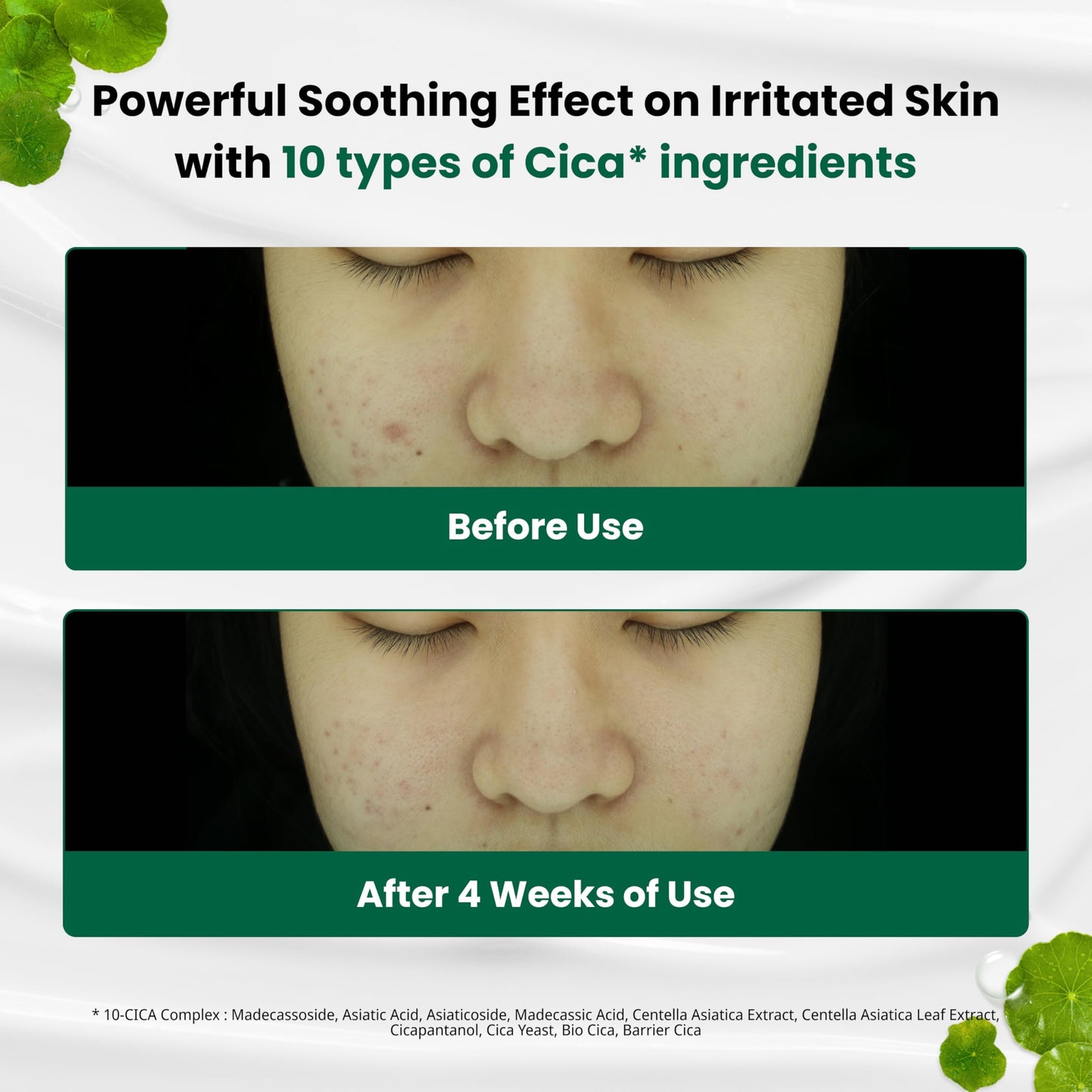 Dr.G Red Blemish Clear Soothing Korean Moisturizer Face Cream, 70ml - Cica Cream, Korean Skin Care Moisturizer, Korean Face Moisturizer, Facial Moisturizer, Korean Skincare, K Beauty Skincare Coreano